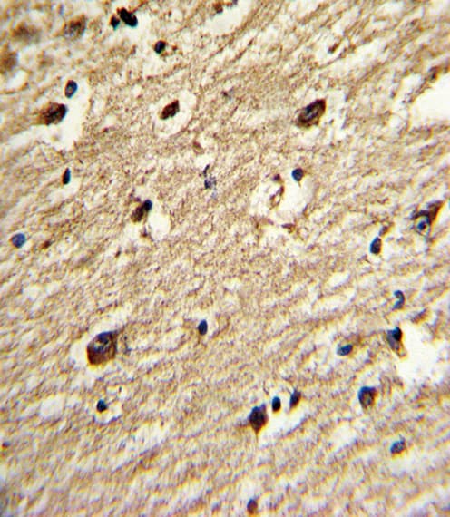 PIAS4 / PIASY Antibody (aa471-499)