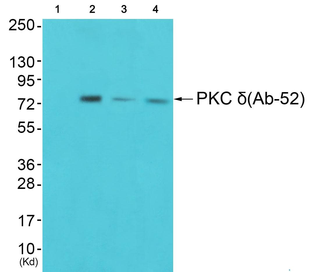 PRKCD / PKC-Delta Antibody (Ab-52)