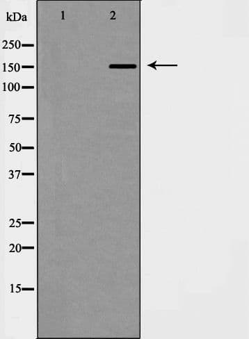 NSD3 / WHSC1L1 Antibody