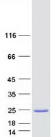 Human ARF1 Protein (Recombinant Myc-DDK (Flag))