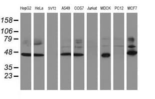 Monoclonal Mouse anti-Human SERPINB1 Antibody (clone OTI2B10, WB)
