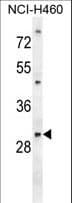 PGAM2 Antibody (aa12-41)