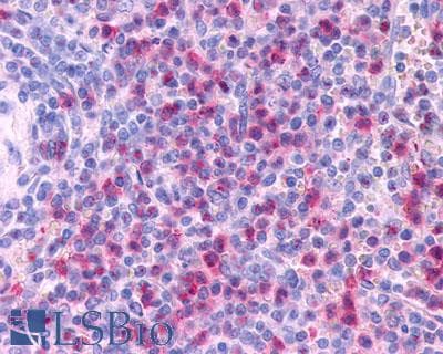 PathPlus™ CCR3 Antibody (Extracellular Domain)