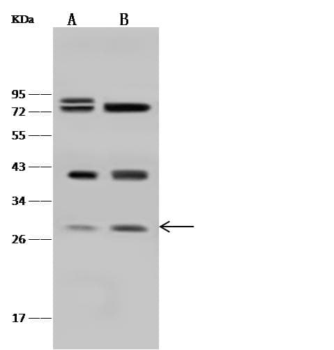Polyclonal Rabbit anti-Human PSMA5 Antibody (Preservative Free, IHC, WB)