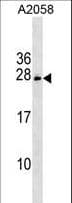 CHCHD6 Antibody (aa136-165)