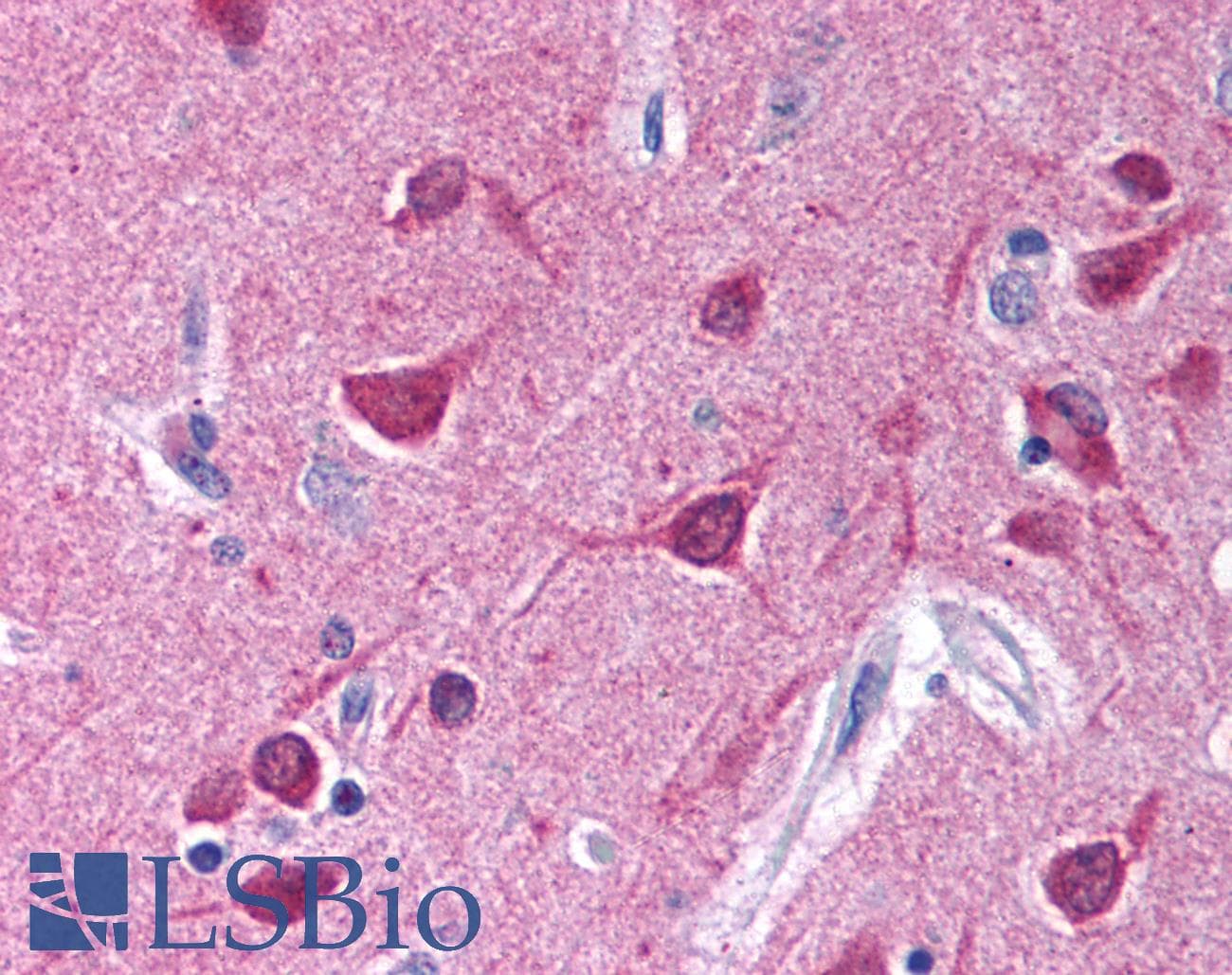 IHC-plus™ Gi Alpha 1/2 Antibody (aa345-354)
