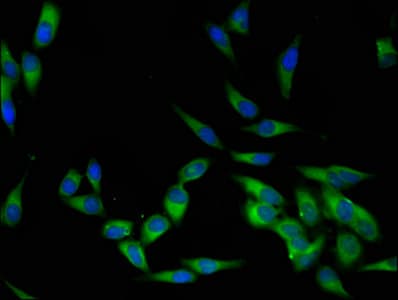 Polyclonal Rabbit anti-Human p56lck / LCK Antibody (aa1-539, WB)