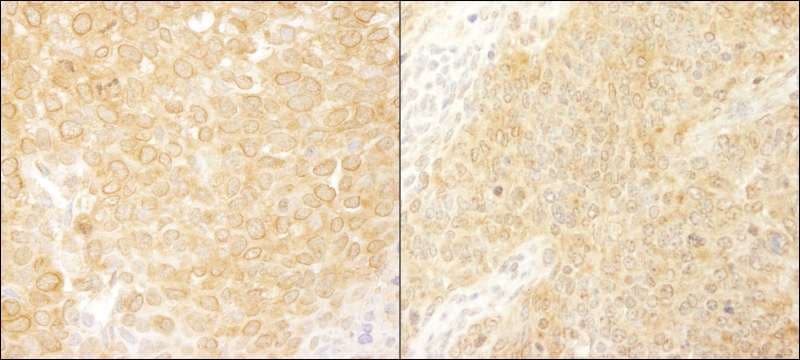 BCAR1 / p130Cas Antibody (aa275-325)