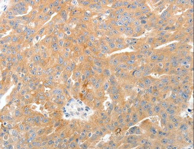 TP1 / TEP1 Antibody
