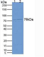 CEA / Carcinoembryonic Antigen Antibody (aa93-221)