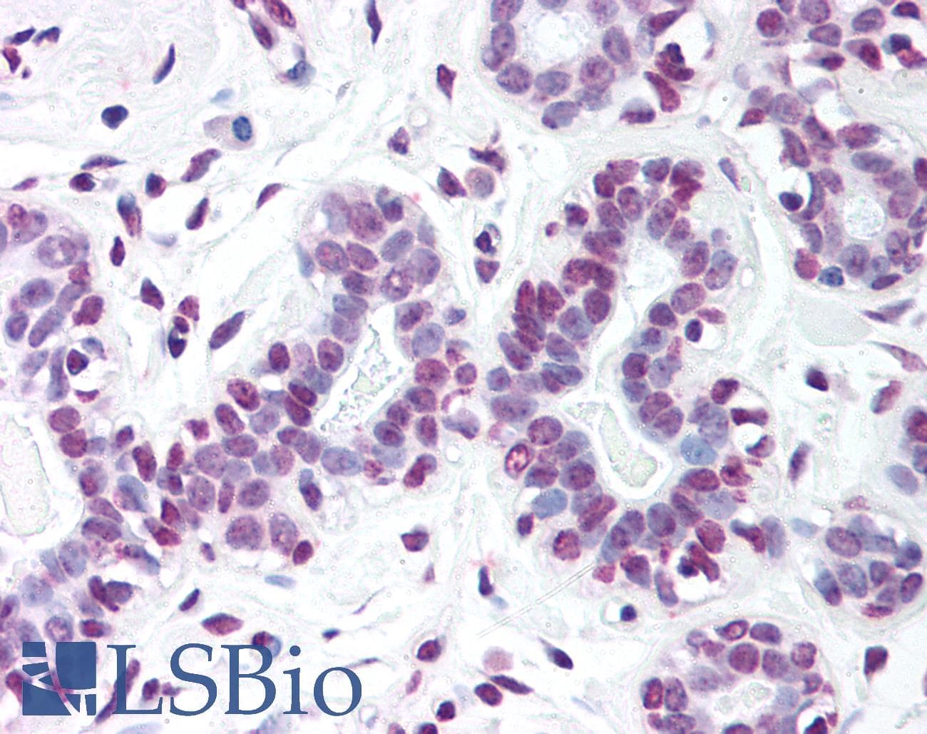 IHC-plus™ SP1 Antibody (Internal)