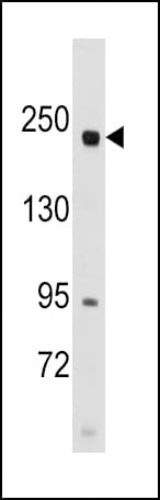 RICTOR Antibody (aa236-267)