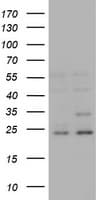 RAB21 Antibody (clone OTI5B12)