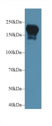 PIK3C2B Antibody (aa790-1025)