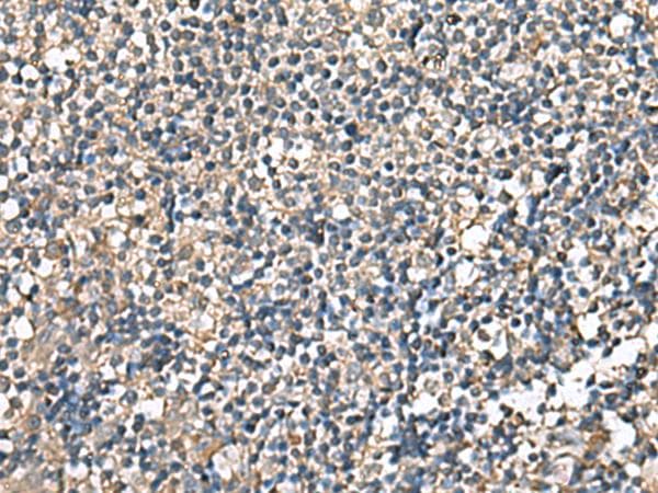 Polyclonal Rabbit anti-Human RPS14 / Ribosomal Protein S14 Antibody (IHC, WB)