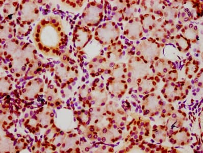 Polyclonal Rabbit anti-Human HIST1H2BN Antibody (IHC, IF, WB)
