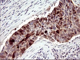 SERPINB3 Antibody (clone OTI2B11)