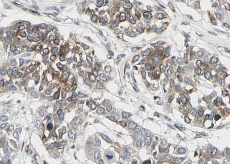 ACE / CD143 Antibody