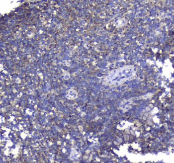 Polyclonal Rabbit anti-Human SYT1 / Synaptotagmin Antibody (IHC, WB)