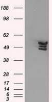 ANXA11 / Annexin XI Antibody (clone OTI1C6)