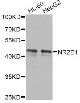 NR2E1 / TLX Antibody