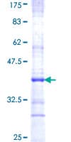 Human PTGER3 / EP3 Protein (Recombinant GST, N-terminus)