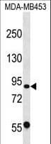 CAPN13 / Calpain 13 Antibody (aa537-565)