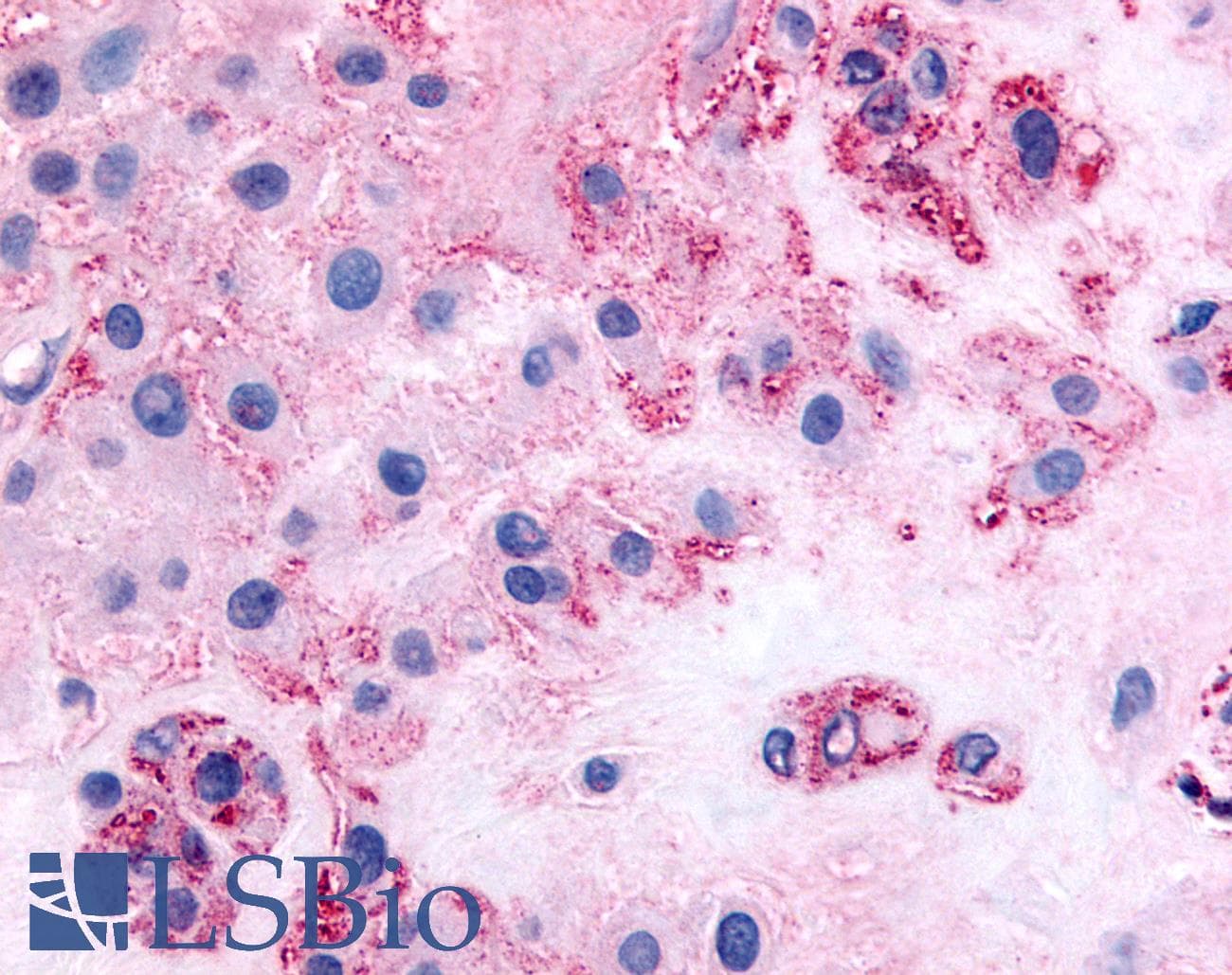 IHC-plus™ NEP / DDR1 Antibody (Internal)