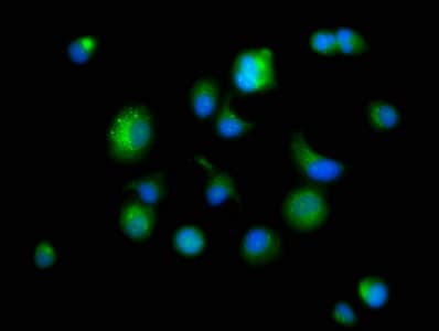 IHC-plus™ PSAP / Prosaposin Antibody