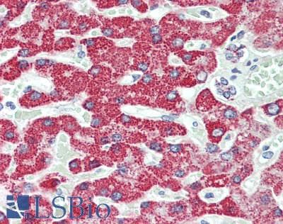 IHC-plus™ ACAA2 Antibody (clone 1C10)