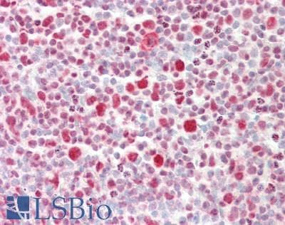 IHC-plus™ Polyclonal Rabbit anti-Human HNRNPC / HNRNP C Antibody (aa222-271, IHC, WB)
