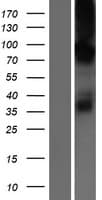 CHPT1 Protein (Over-Expression Lysate Myc-DDK (Flag))