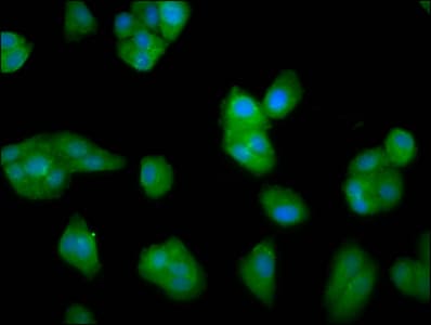 Polyclonal Rabbit anti-Human LCE3C Antibody (IF)