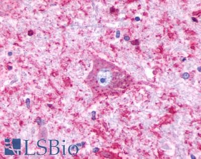 PathPlus™ HTR4 / 5-HT4 Receptor Antibody (Cytoplasmic Domain)