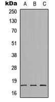 Polyclonal Rabbit anti-Human SYT8 Antibody (Internal, WB)
