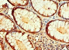 Polyclonal Rabbit anti-Human IDH1 / IDH Antibody (aa1-240, IHC, WB)