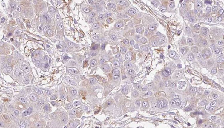 Polyclonal Rabbit anti-Human P2Y10 / P2RY10 Antibody (aa133-152, IHC, IF, WB)
