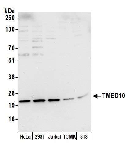 TMED10 / TMP21 Antibody (aa50-100)