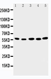 ABI2B / ABI2 Antibody (aa158-173)