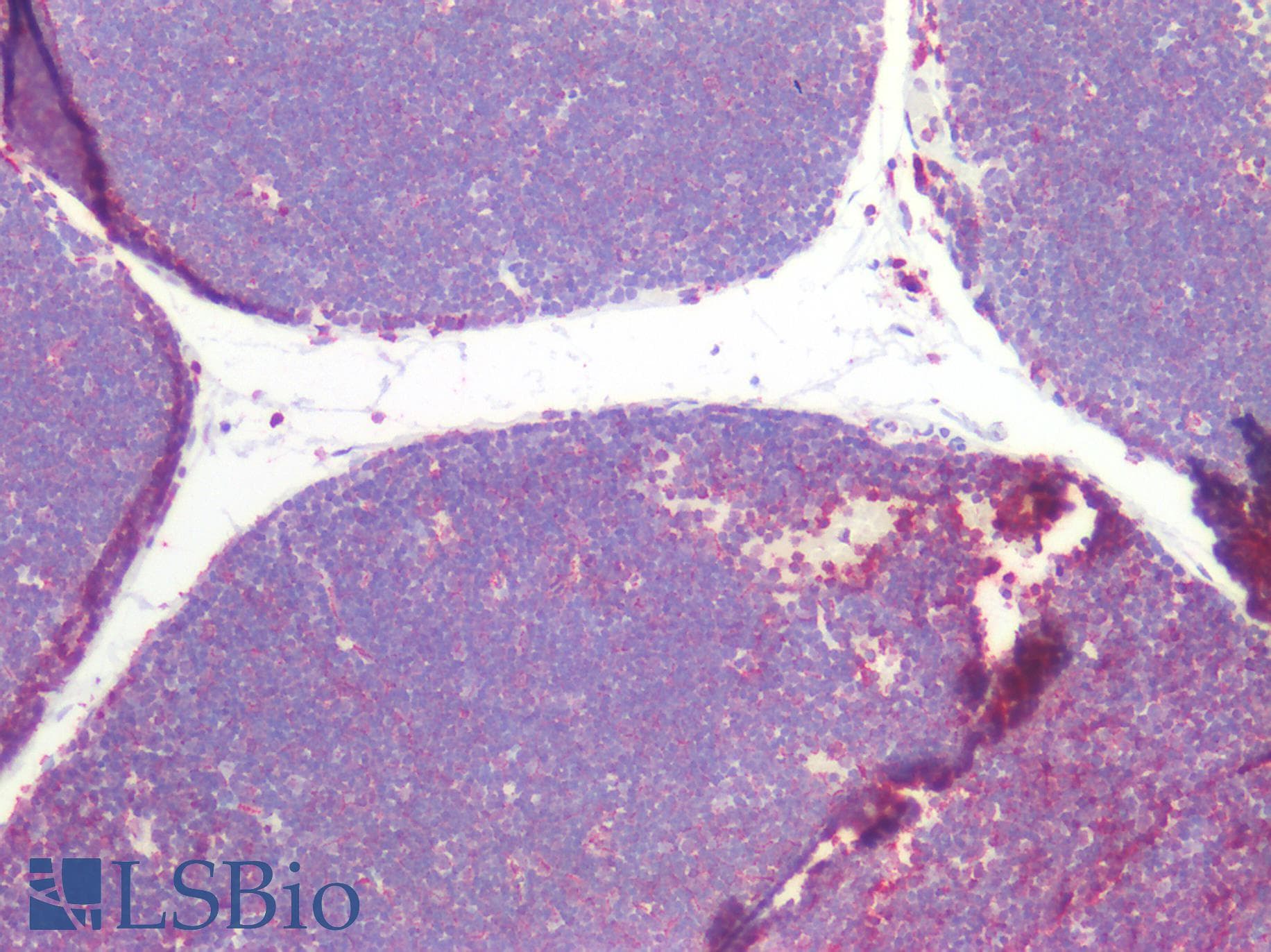 PathPlus™ CD45RO Antibody (clone UCHL-1)