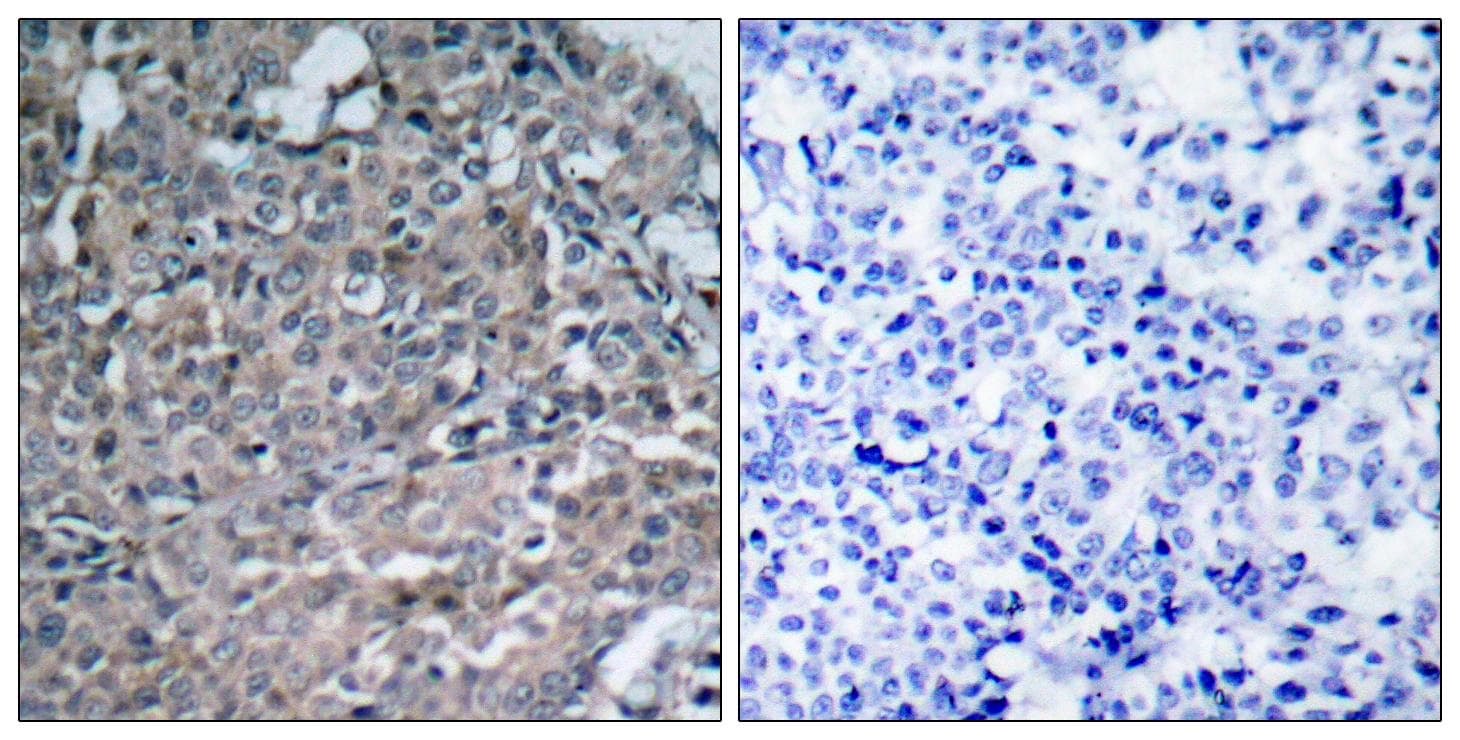 Polyclonal Rabbit anti-Human FAK / Focal Adhesion Kinase Antibody (p925, IHC, WB)