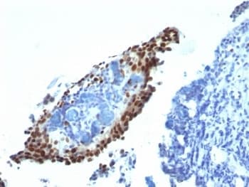 CDKN1A / WAF1 / p21 Antibody (clone HJ21)