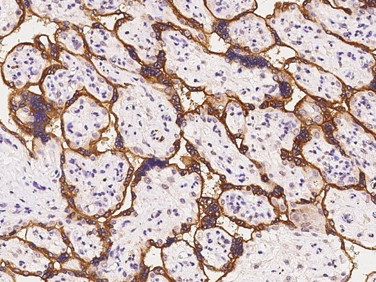 ADAM12 Antibody