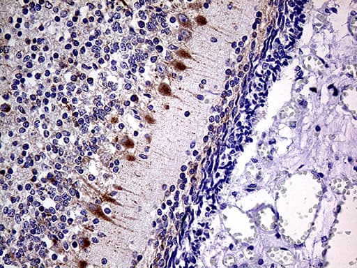 Monoclonal Mouse anti-Human SLC22A17 Antibody (clone OTI2D6, aa241-300, IHC, WB)