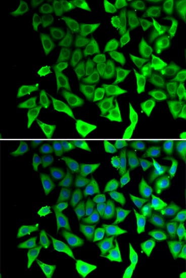 IHC-plus™ PTGES2 Antibody