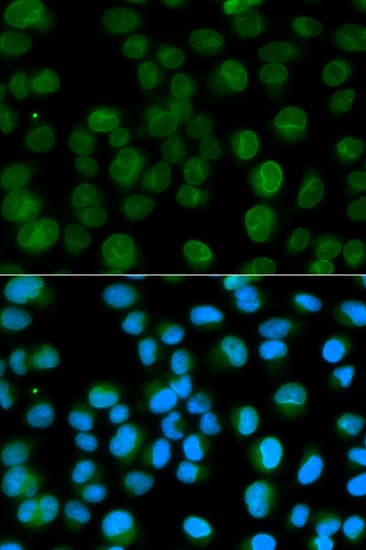Polyclonal Rabbit anti-Human EMD / Emerin Antibody (IHC, IF, WB)