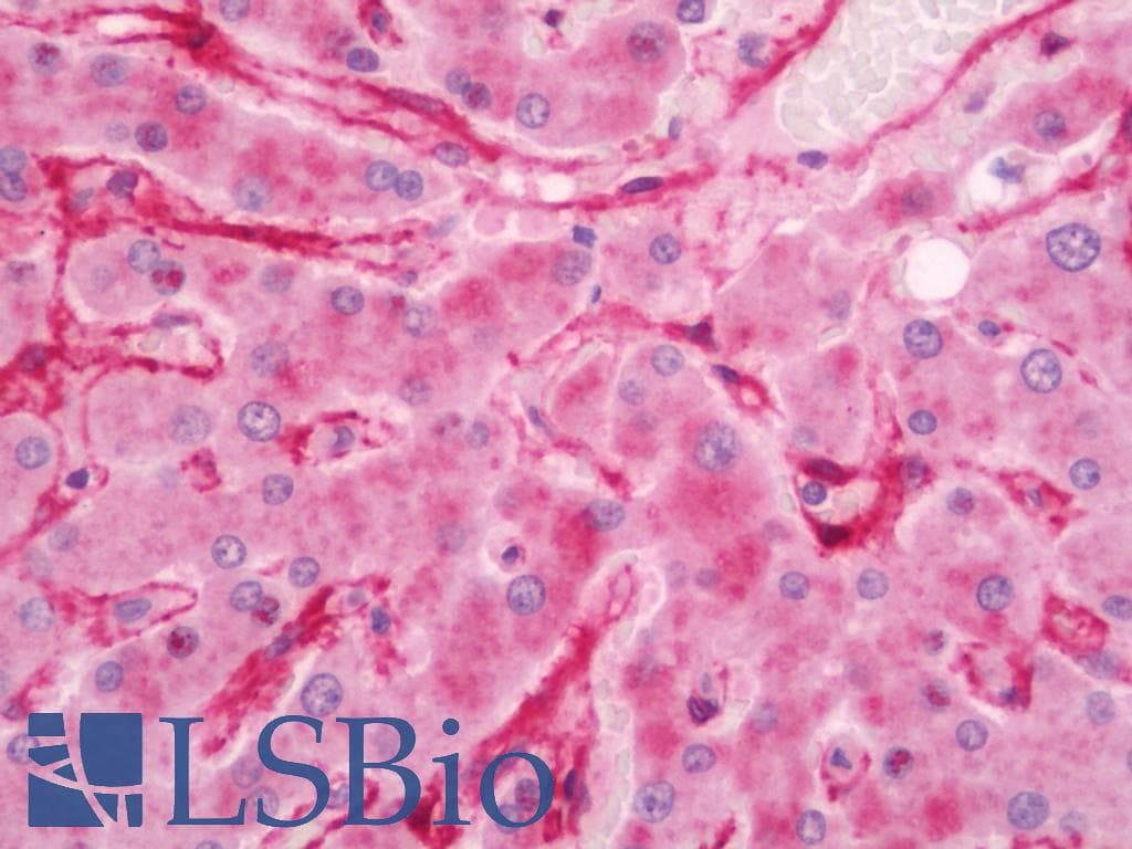 IHC-plus™ CAV2 / Caveolin 2 Antibody