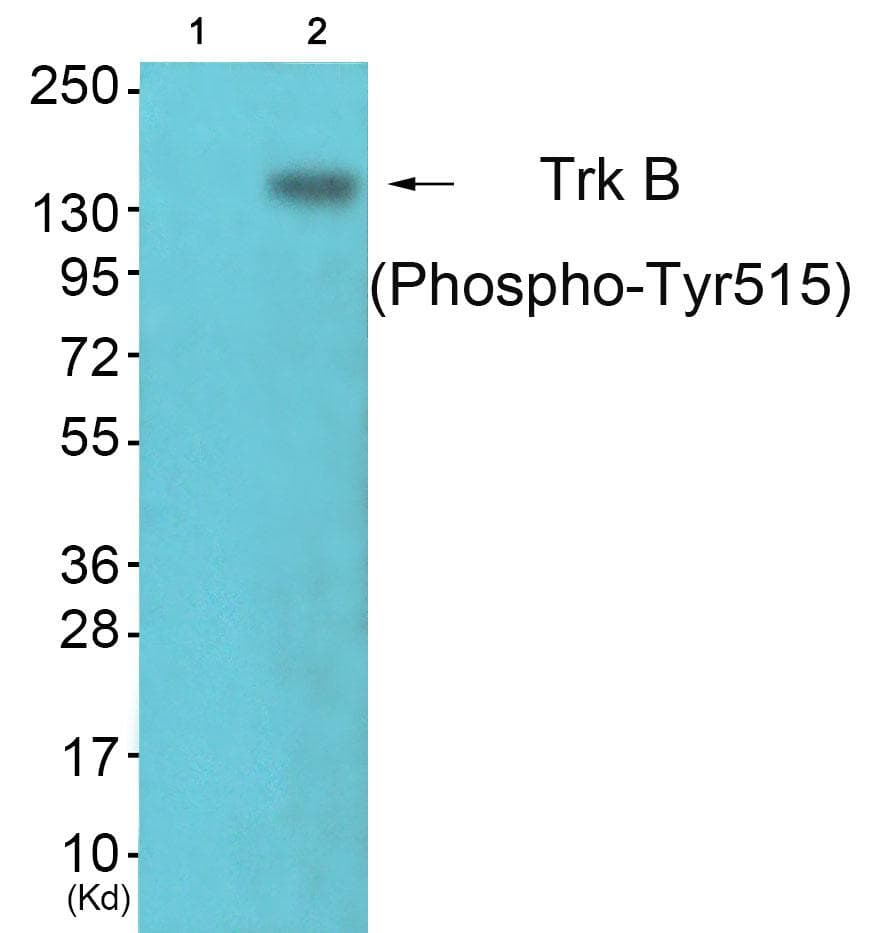 Polyclonal Rabbit anti-Human NTRK2 / TRKB Antibody (phospho-Tyr515, IHC, WB)