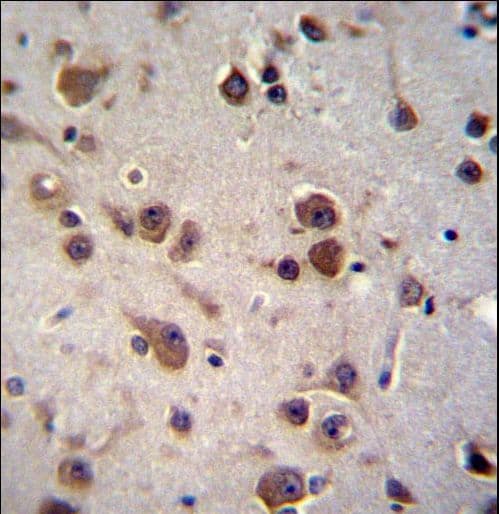 CHST6 Antibody (aa296-325)