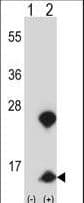 Polyclonal Rabbit anti-Human HMGN1 / HMG14 Antibody (aa1-30, IHC, WB)
